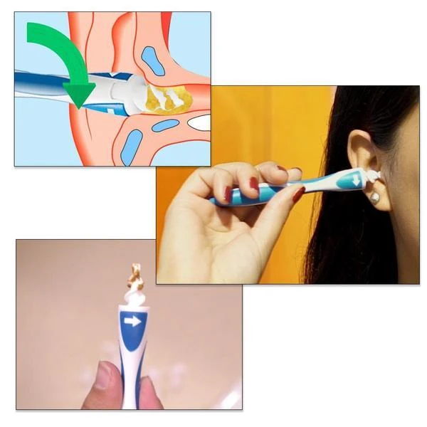 Smart Ear Cleaner - 16 Tips Rotating Ear Cleaner with Soft Silicone Tips Safety Remove the Earwax Tool Simply To Grab And Extract Earwax - 5econds.co