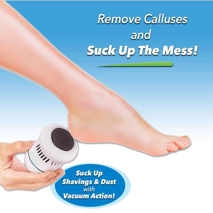 Electric Callus Remover - Built-In Vacuum Rechargeable Motorized Feet Foot Pedicure Tool Exfoliation Dead Skin - 5econds.co
