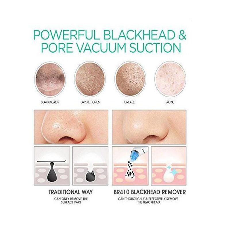 Professional Electric Blackhead Vacuum - 5econds.co