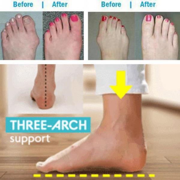 BESTWALK™ Orthopedic Premium Toe Corrector Bunion Comfy Foot Sandals - 5econds.co